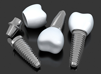 Implant supported dental crown animation
