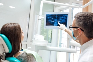 Falmouth implant dentist explaining implant placement surgery via X-ray
