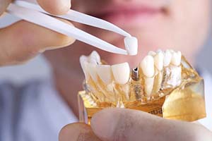 dentist placing a crown on a dental implant model
