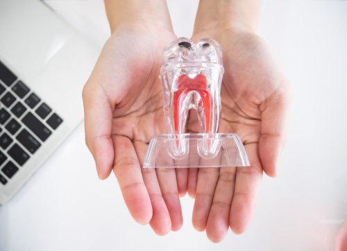 Dentist holding a transparent model of a tooth