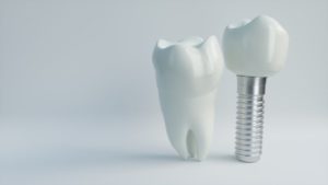 dental implant in Casco Bay next to natural tooth 