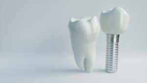 dental implant in Casco Bay next to natural tooth