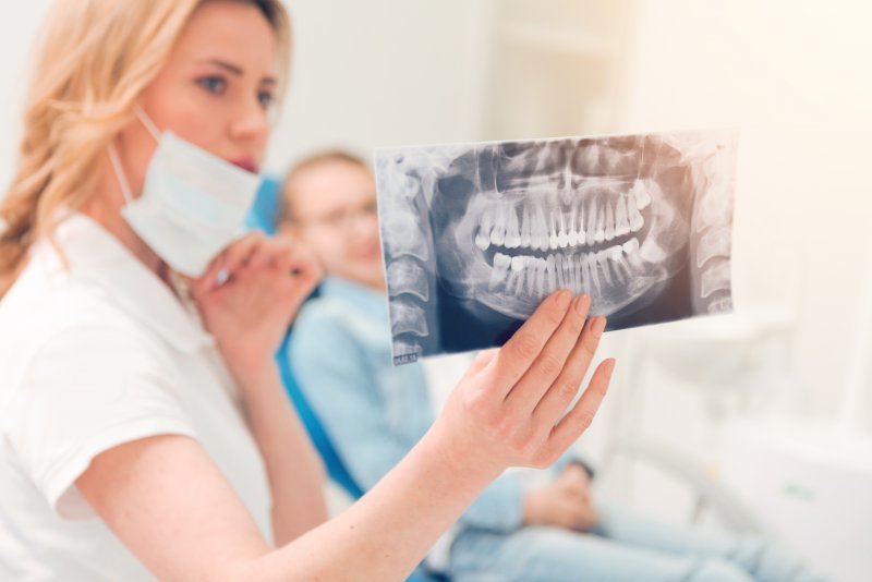 dentist showing an x-ray of wisdom teeth
