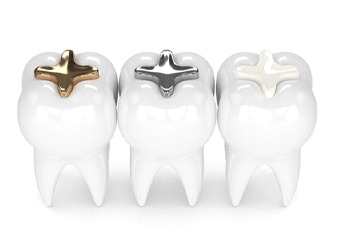 Close-up of a tooth-colored composite resin filling